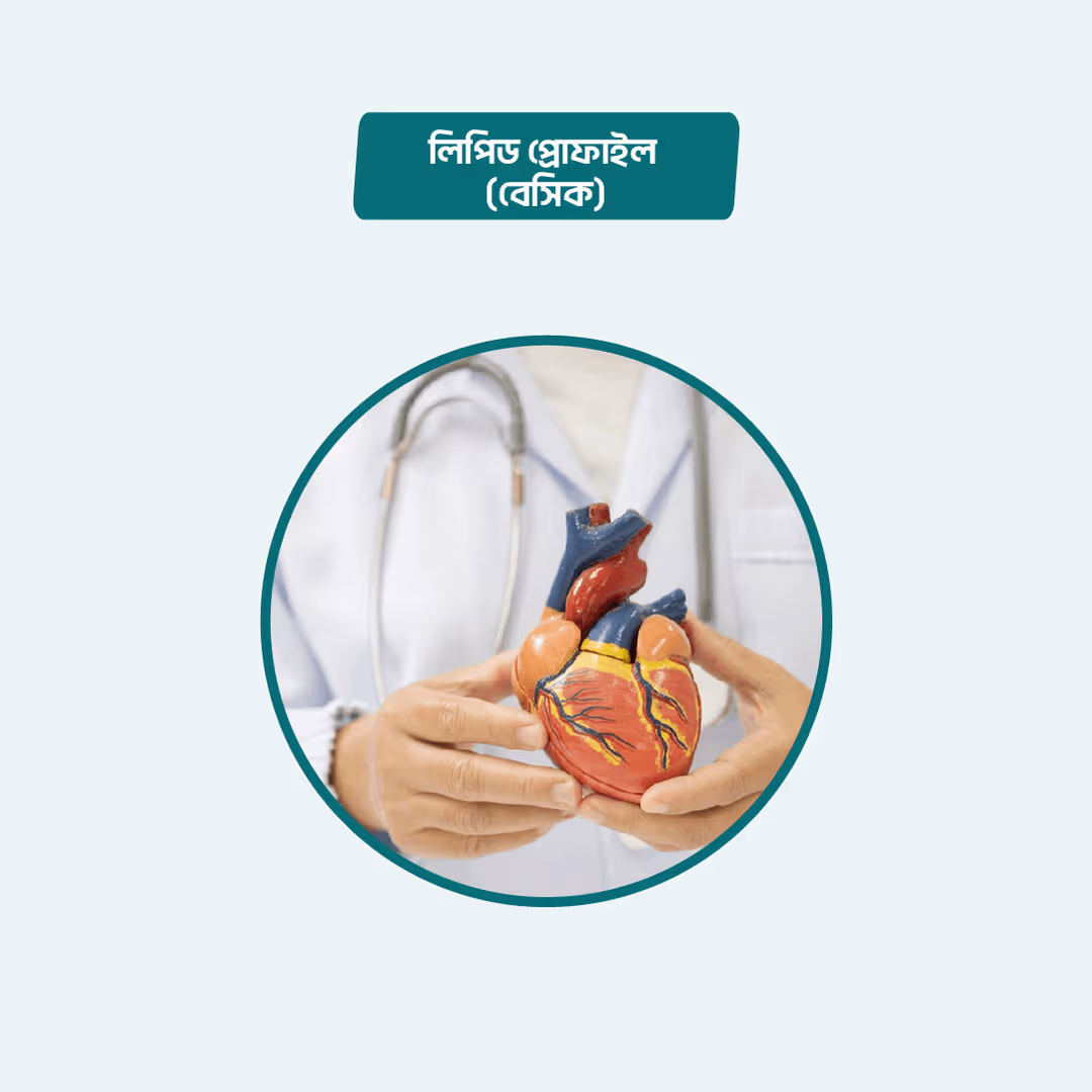 Lipid Profile (Fasting/Regular)