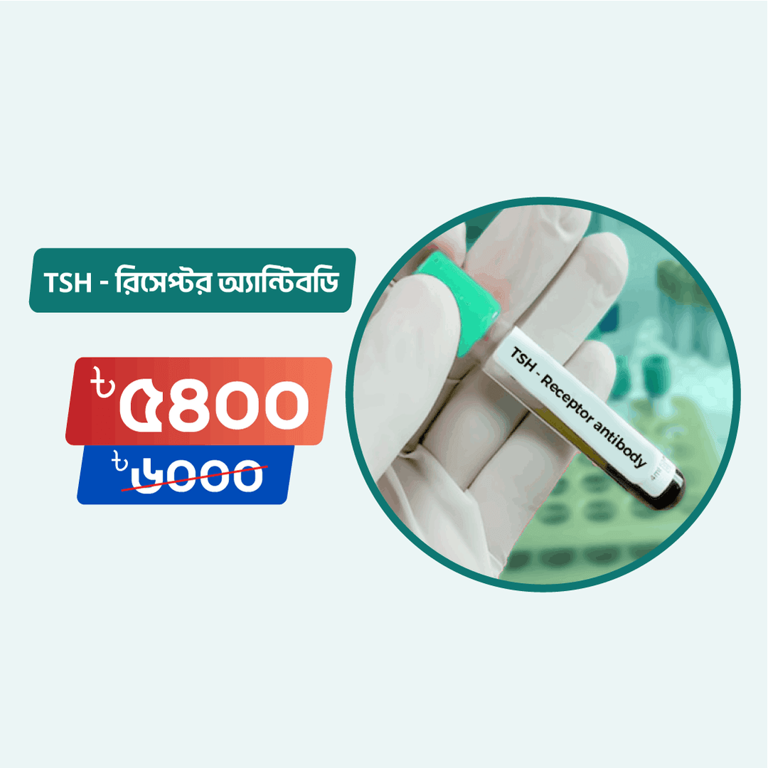 TSH - Receptor antibody