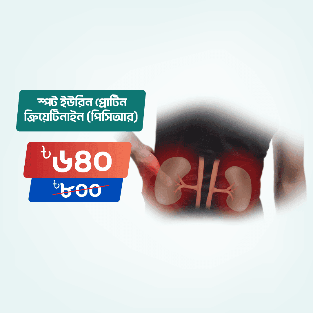 Spot Urine Protein Creatinine Ratio (PCR)