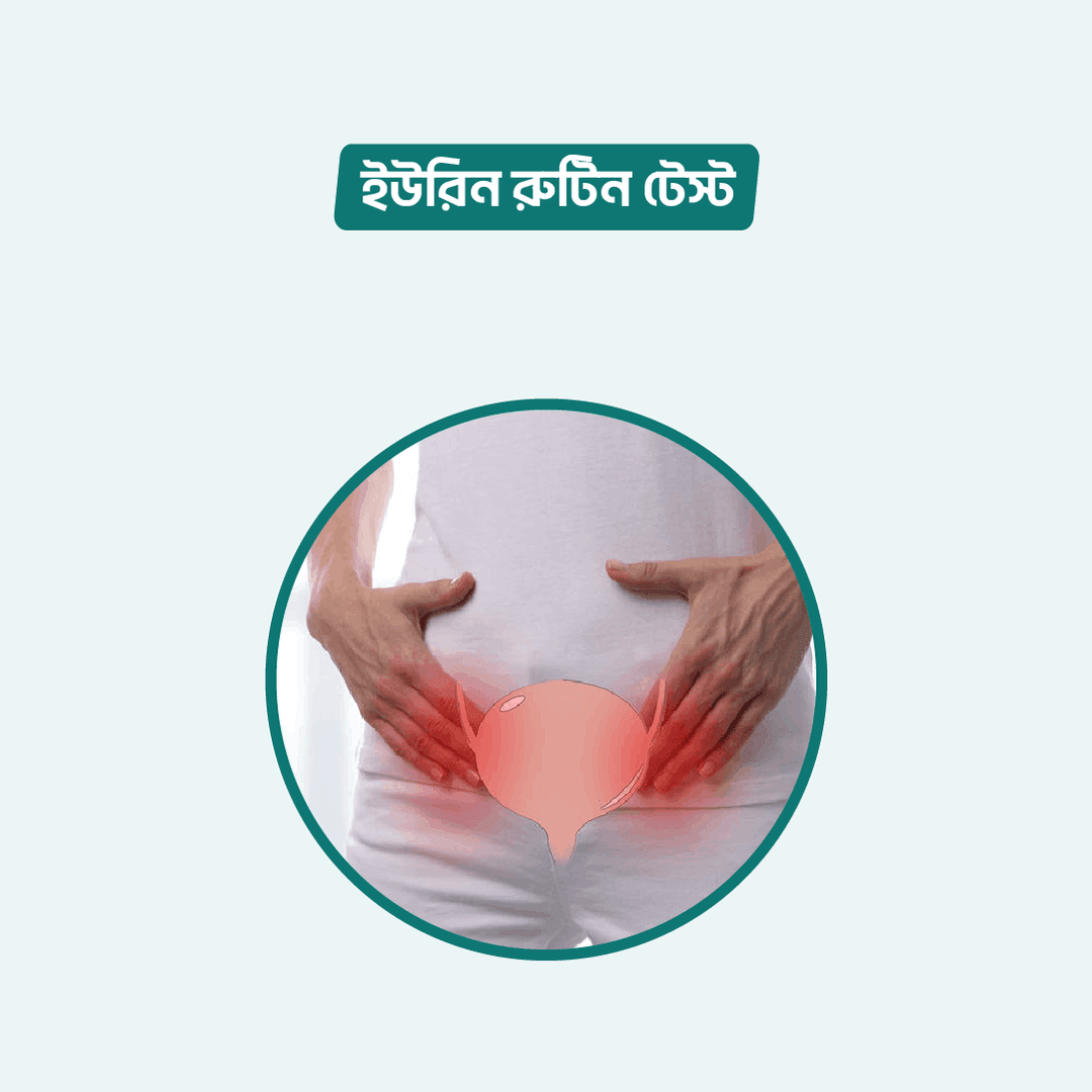 Urine Routine Examination (Urine R/E)