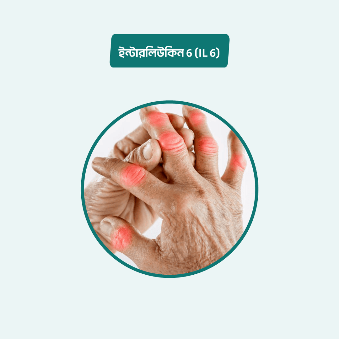 Interleukin-6