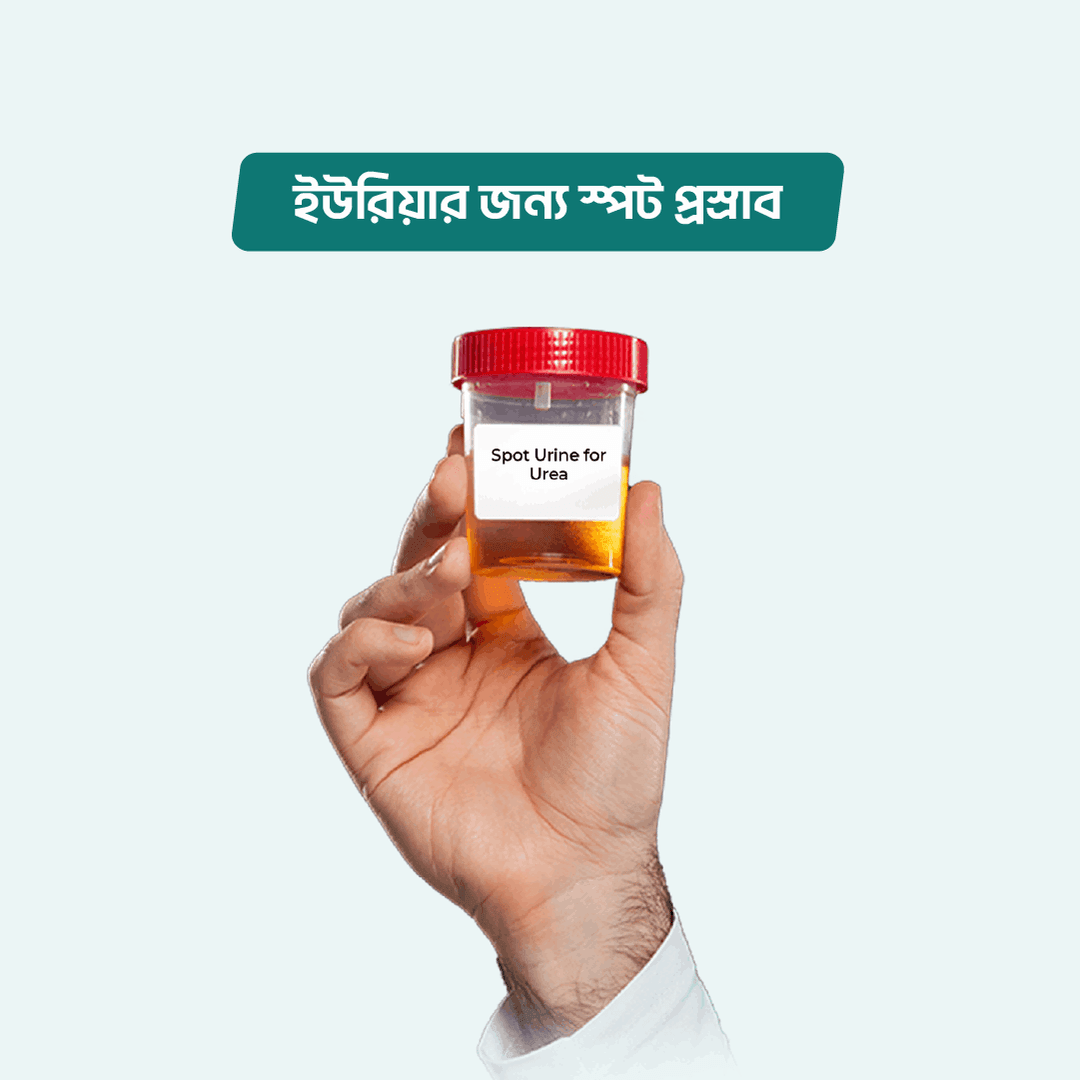 Spot Urine for Urea