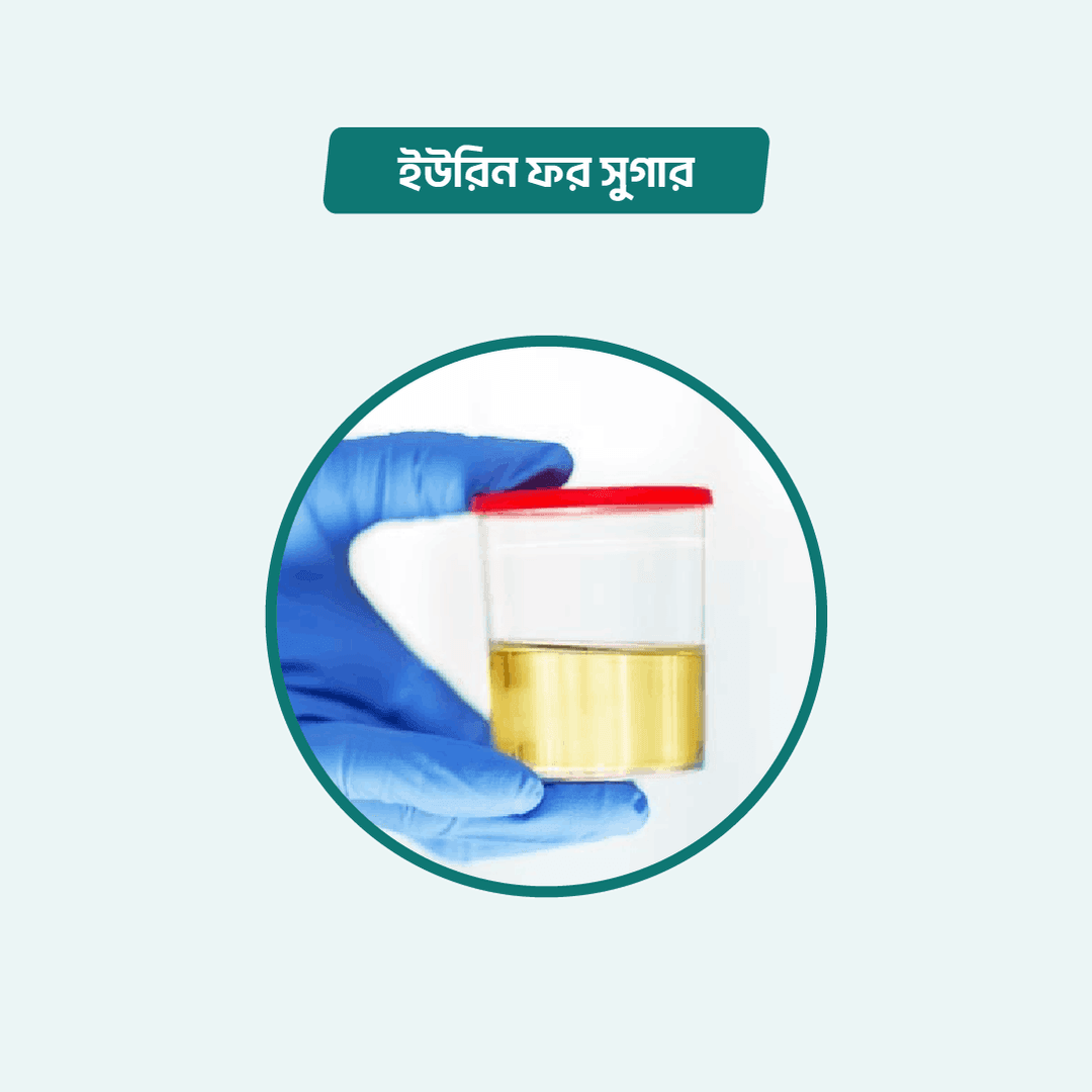Urine for Sugar