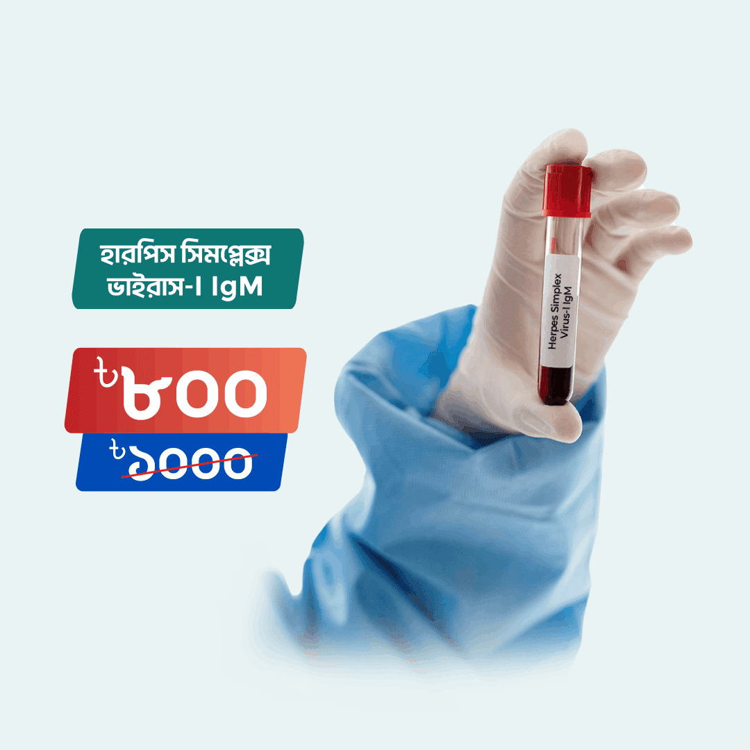 Herpes Simplex Virus Type 1 Ab IgM