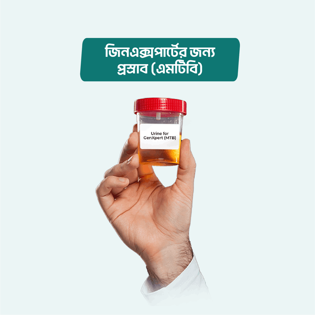 Urine for GeneXpert (MTB)