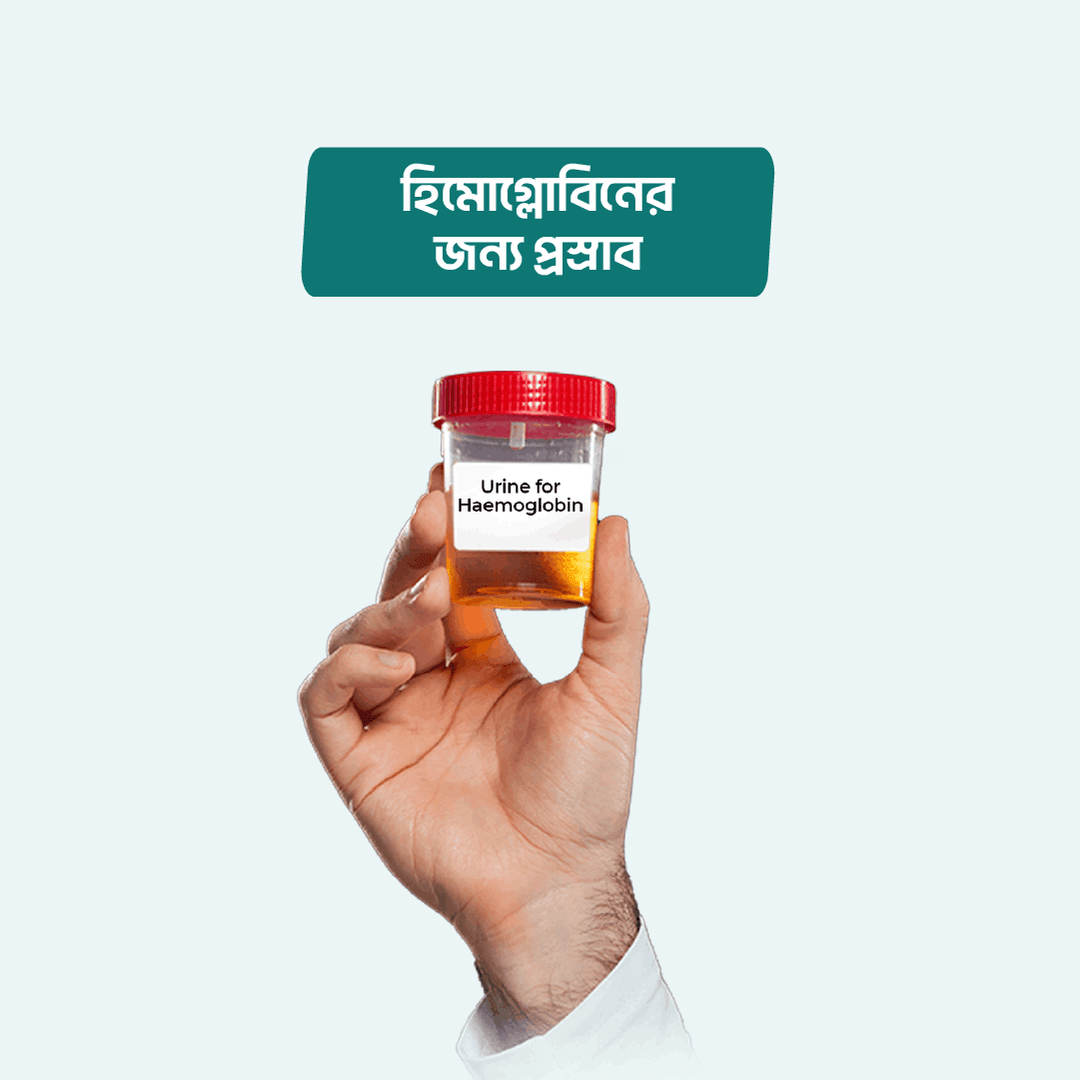 Urine for Haemoglobin