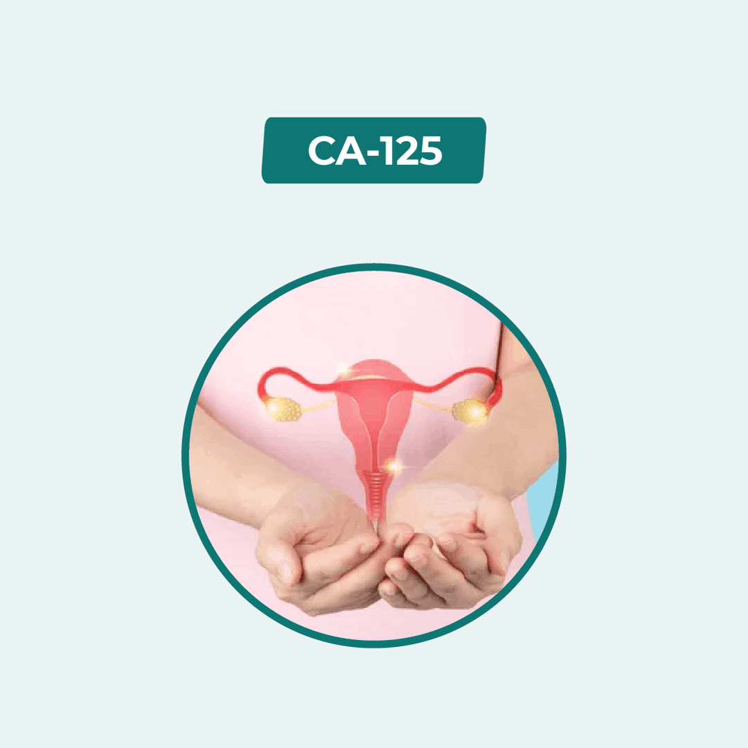 CA 125 (Ovarian cancer marker)