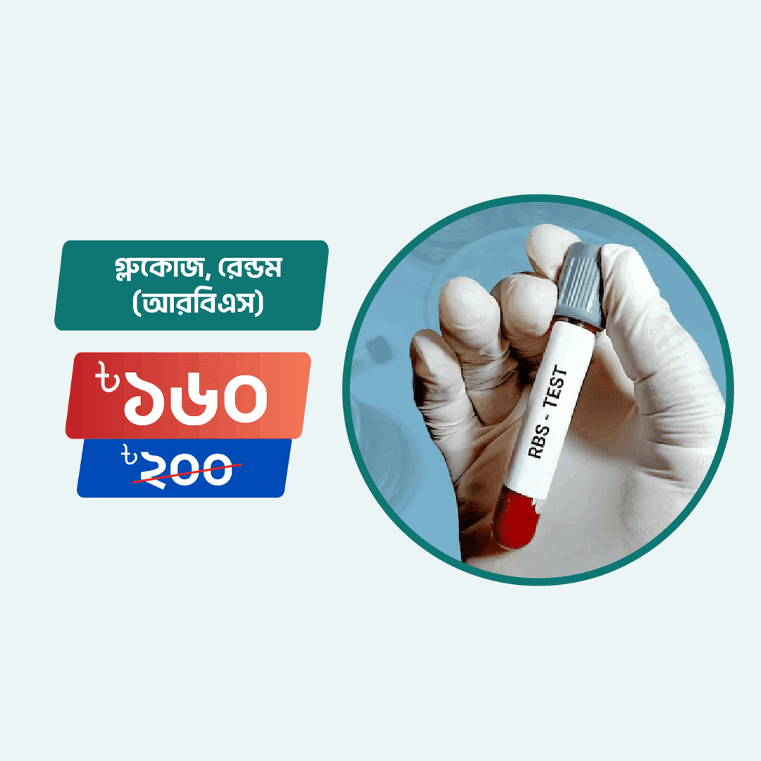 Glucose, Random (RBS)