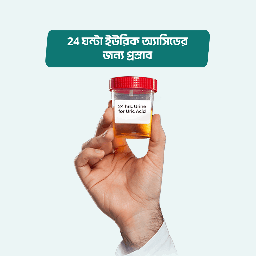 24 hrs. Urine for Uric Acid