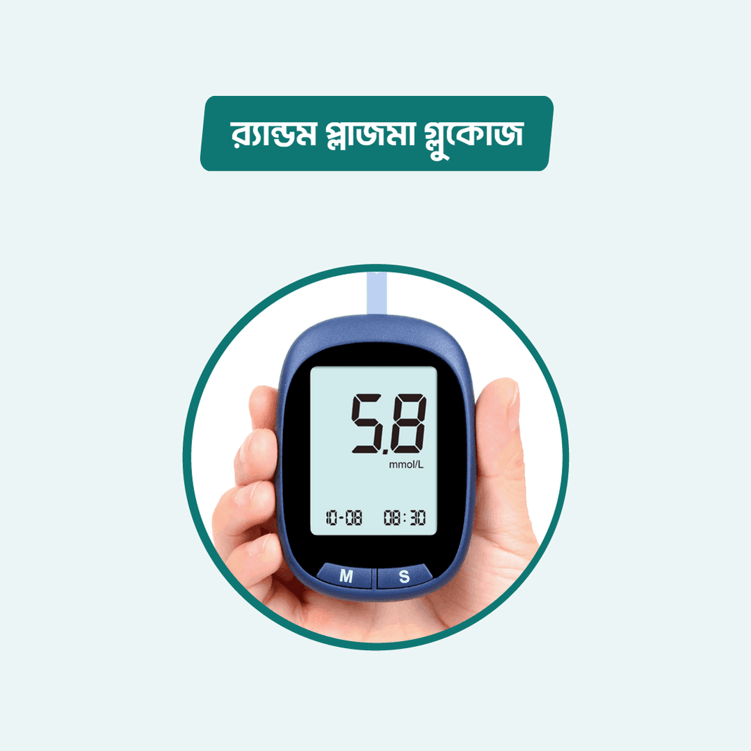 Random Plasma glucose (RBS)