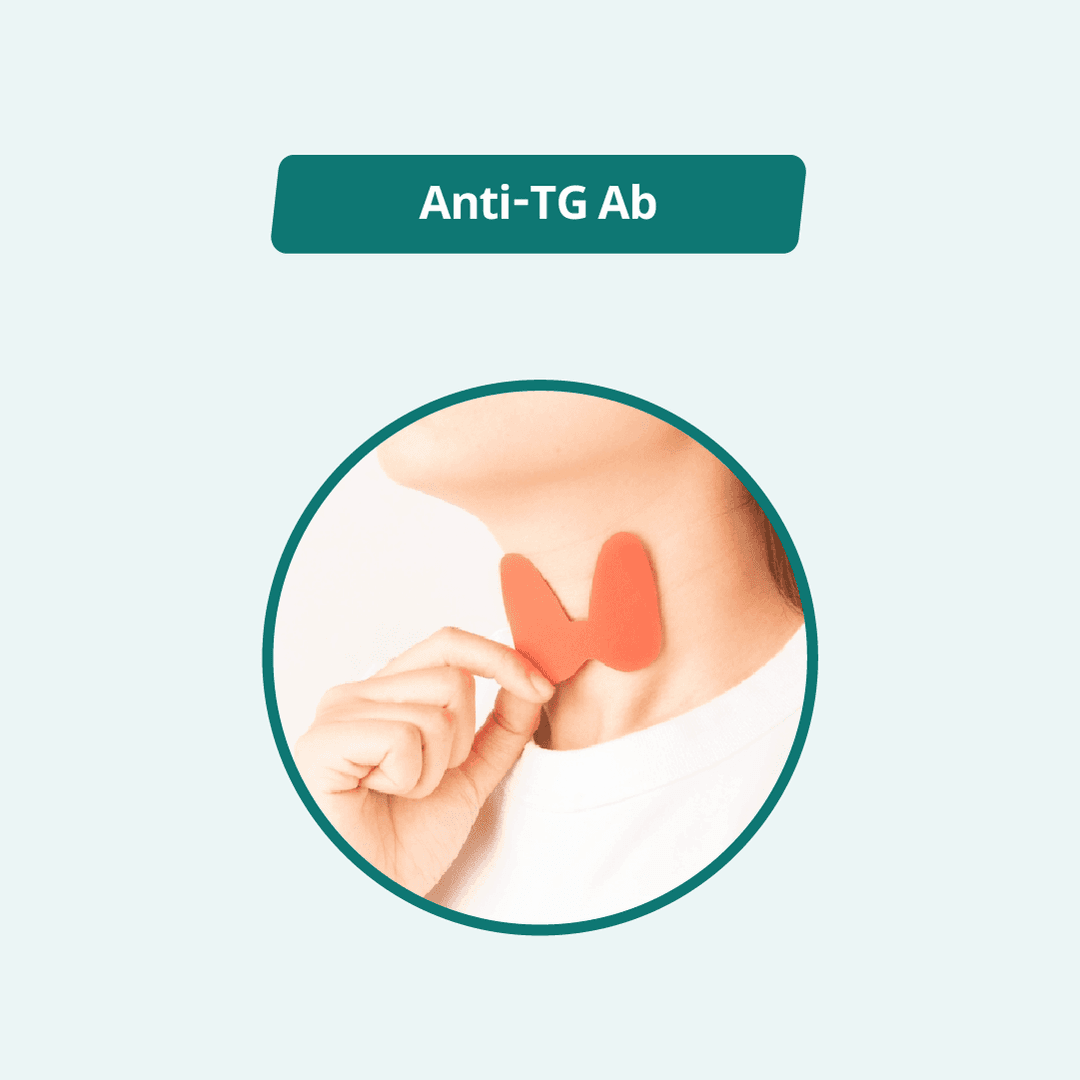 Anti-TG Ab