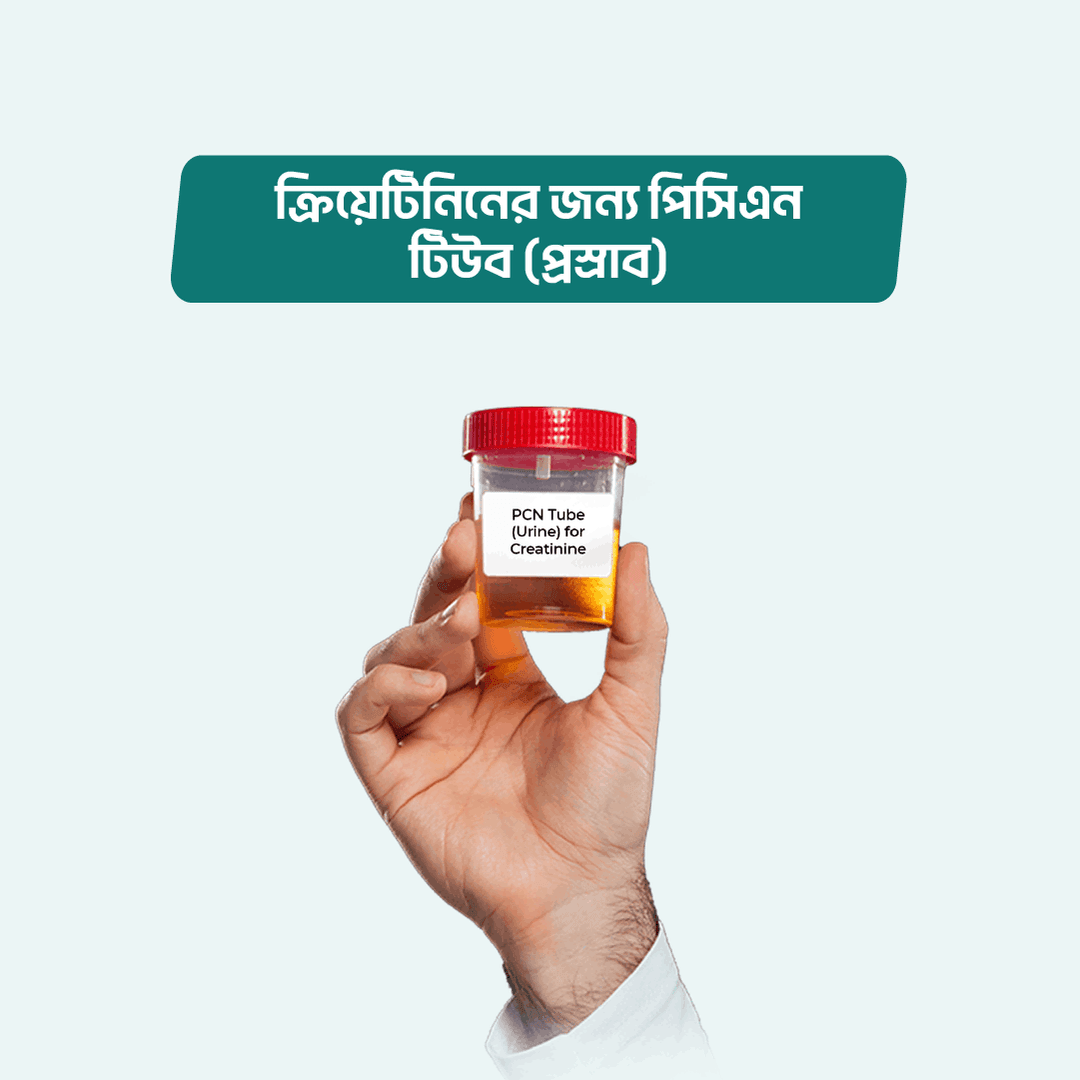 PCN Tube (Urine) for Creatinine