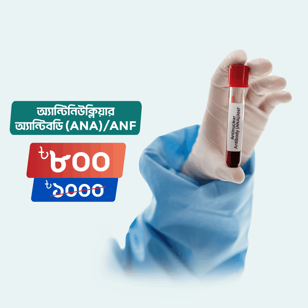 Antinuclear Antibody (ANA)/ANF