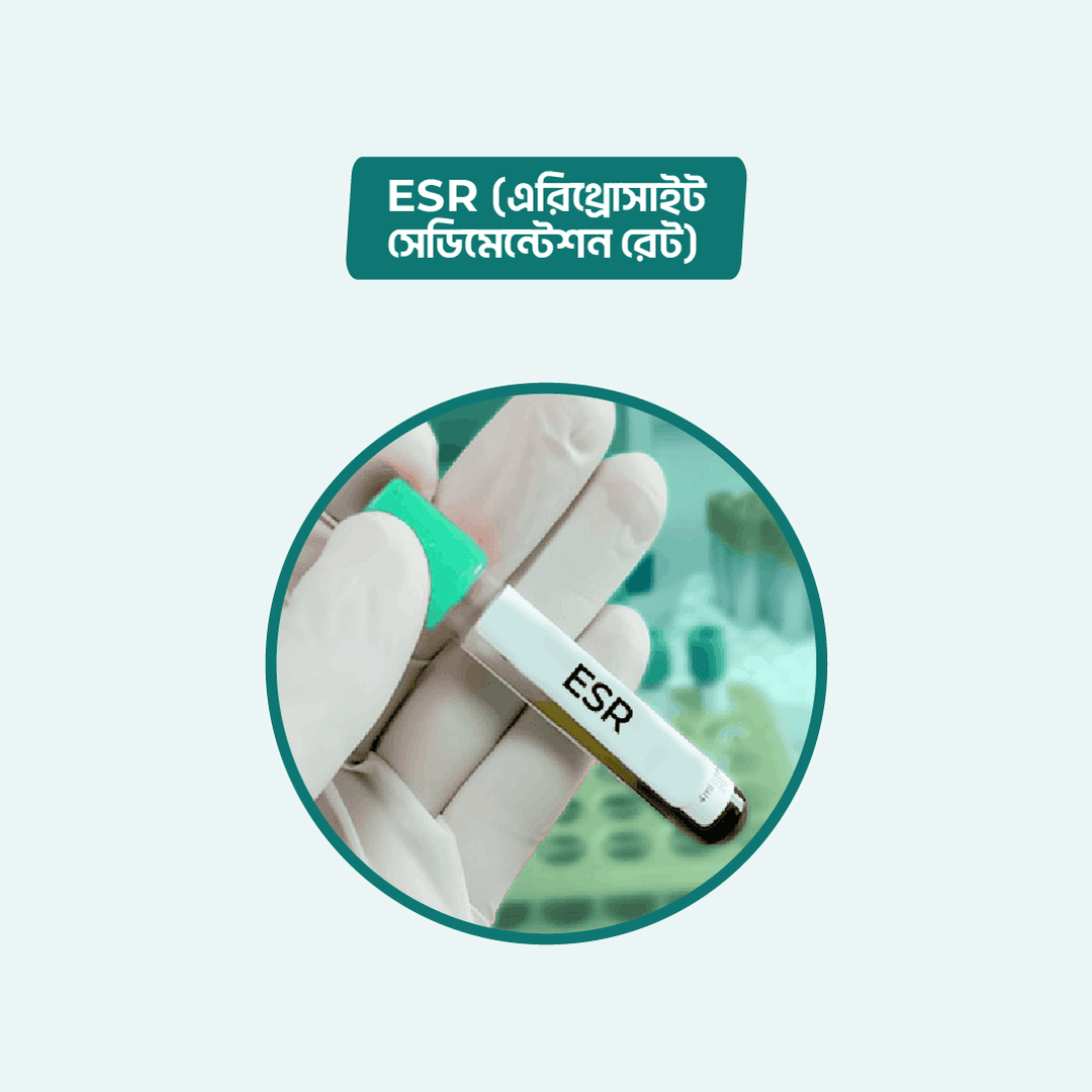 ESR