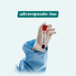 Protein Electrophoresis