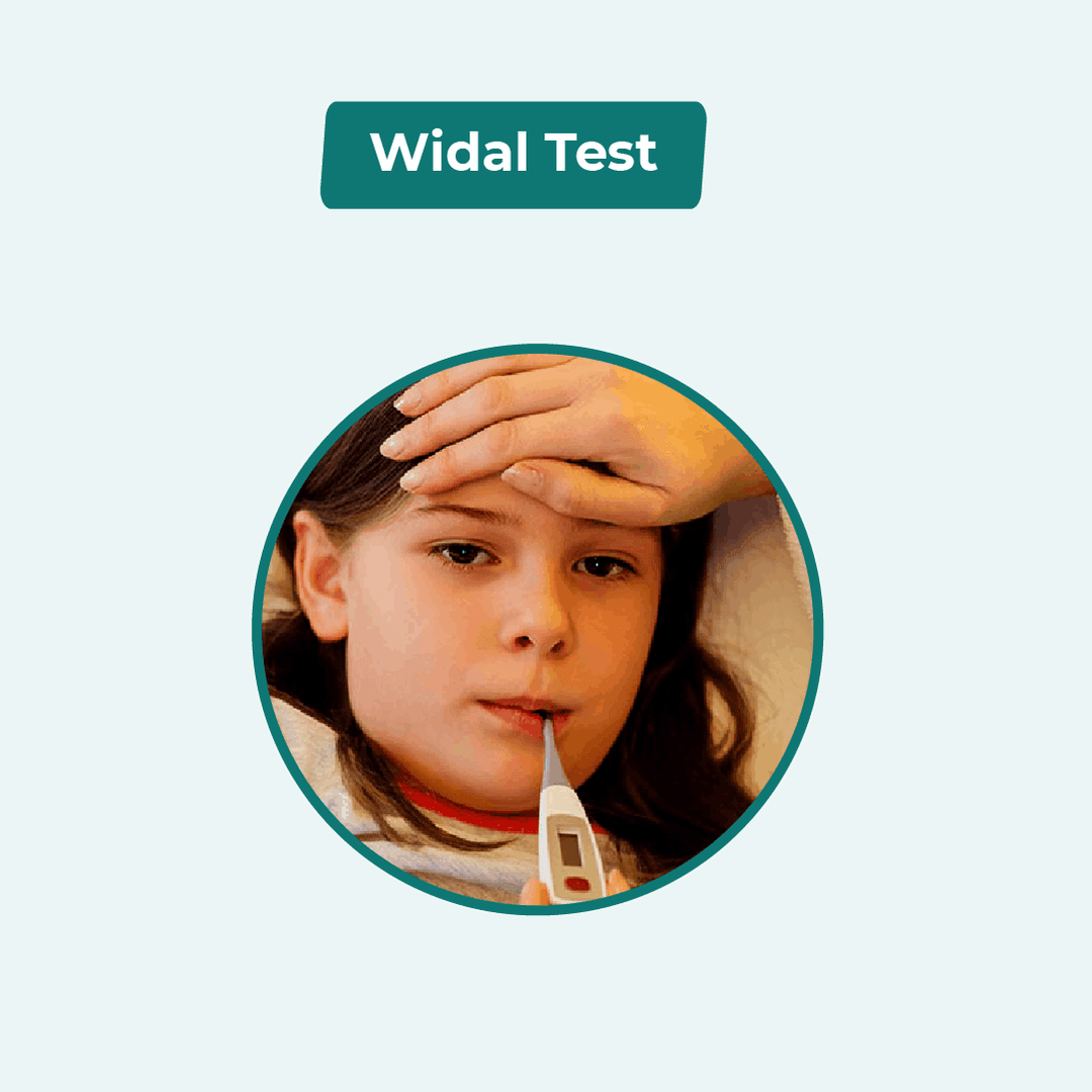 Widal Test
