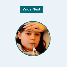 Widal Test