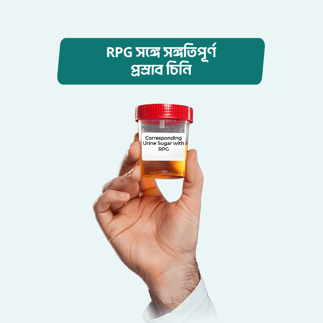 Corresponding Urine Sugar with RPG