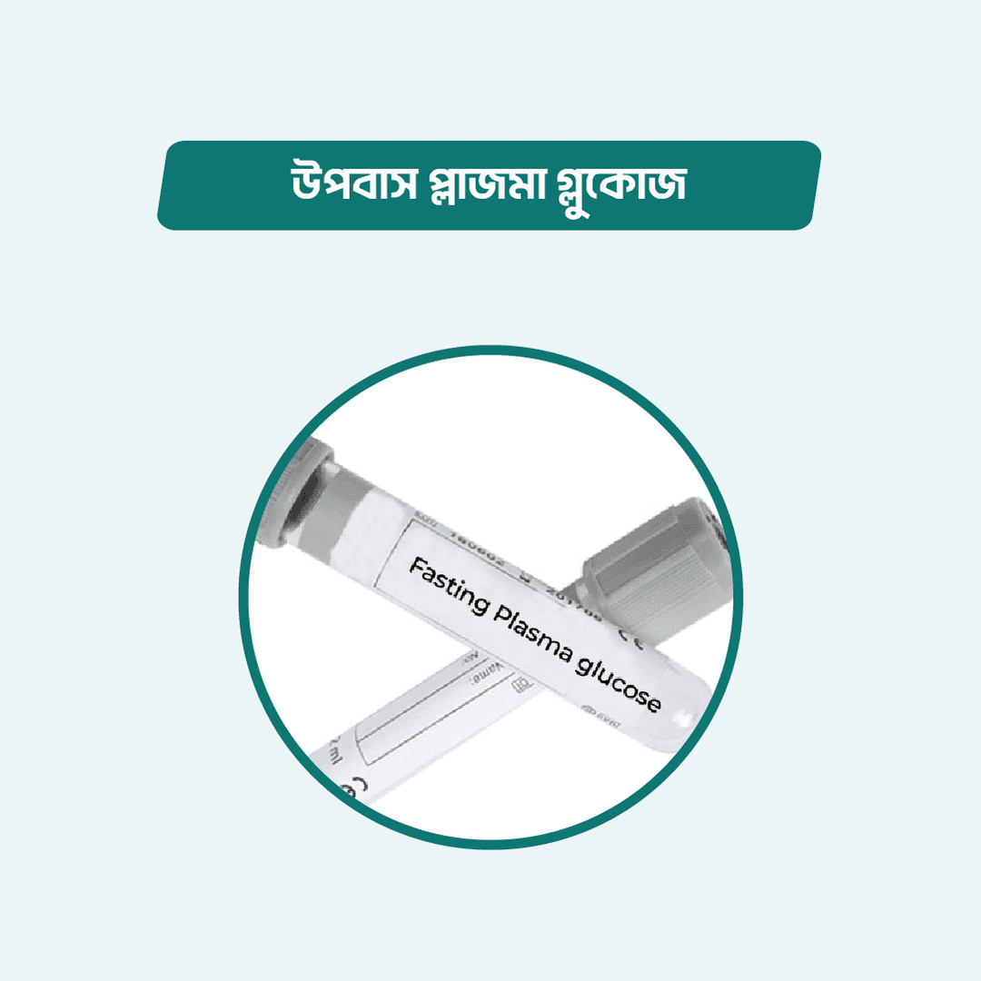 Fasting Plasma glucose (FBS)