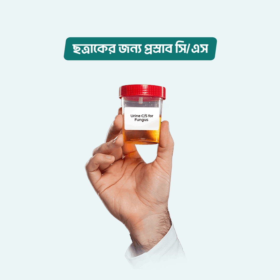 Urine C/S for Fungus