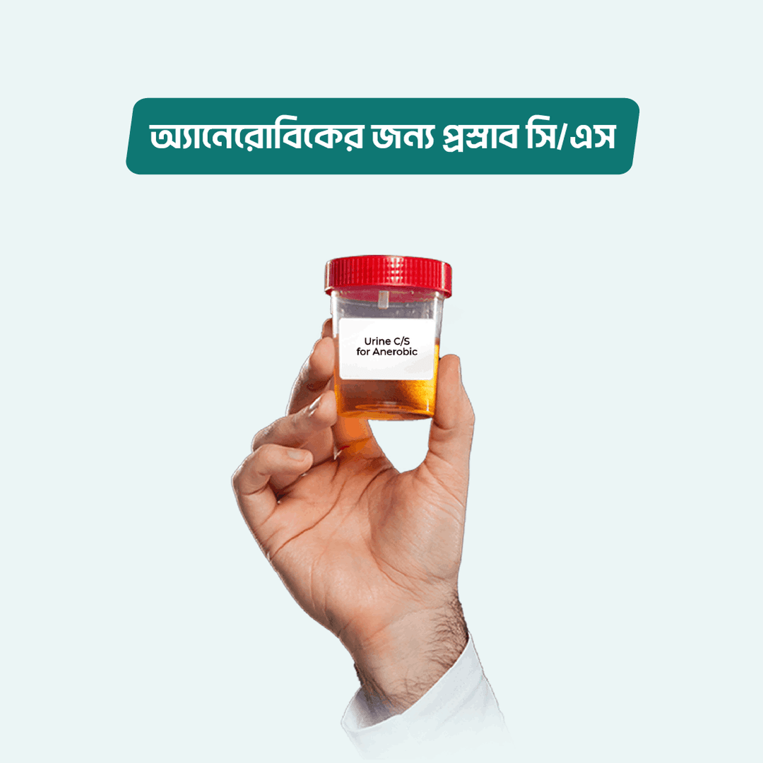 Urine C/S for Anerobic