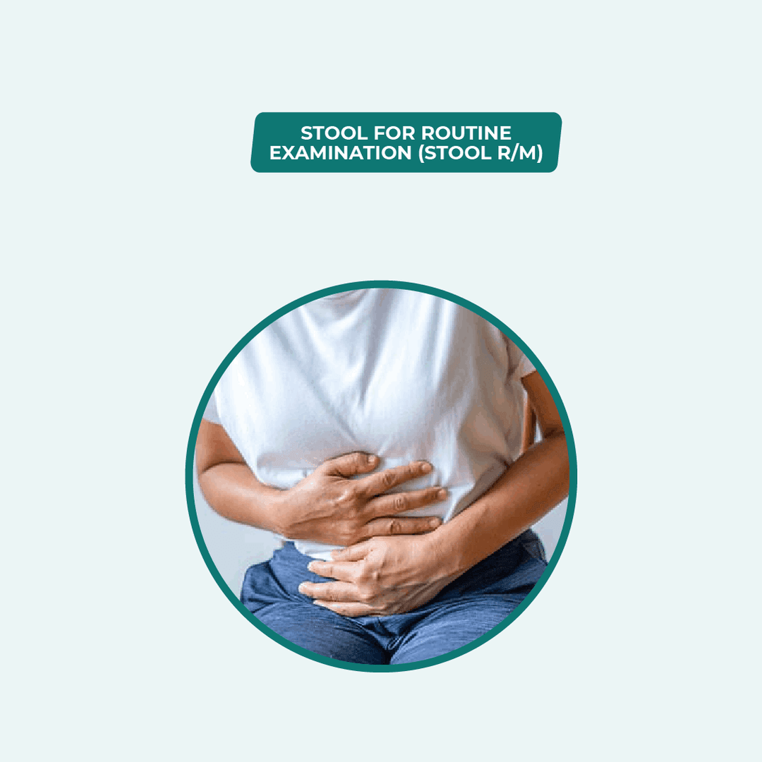 Stool Routine Examination