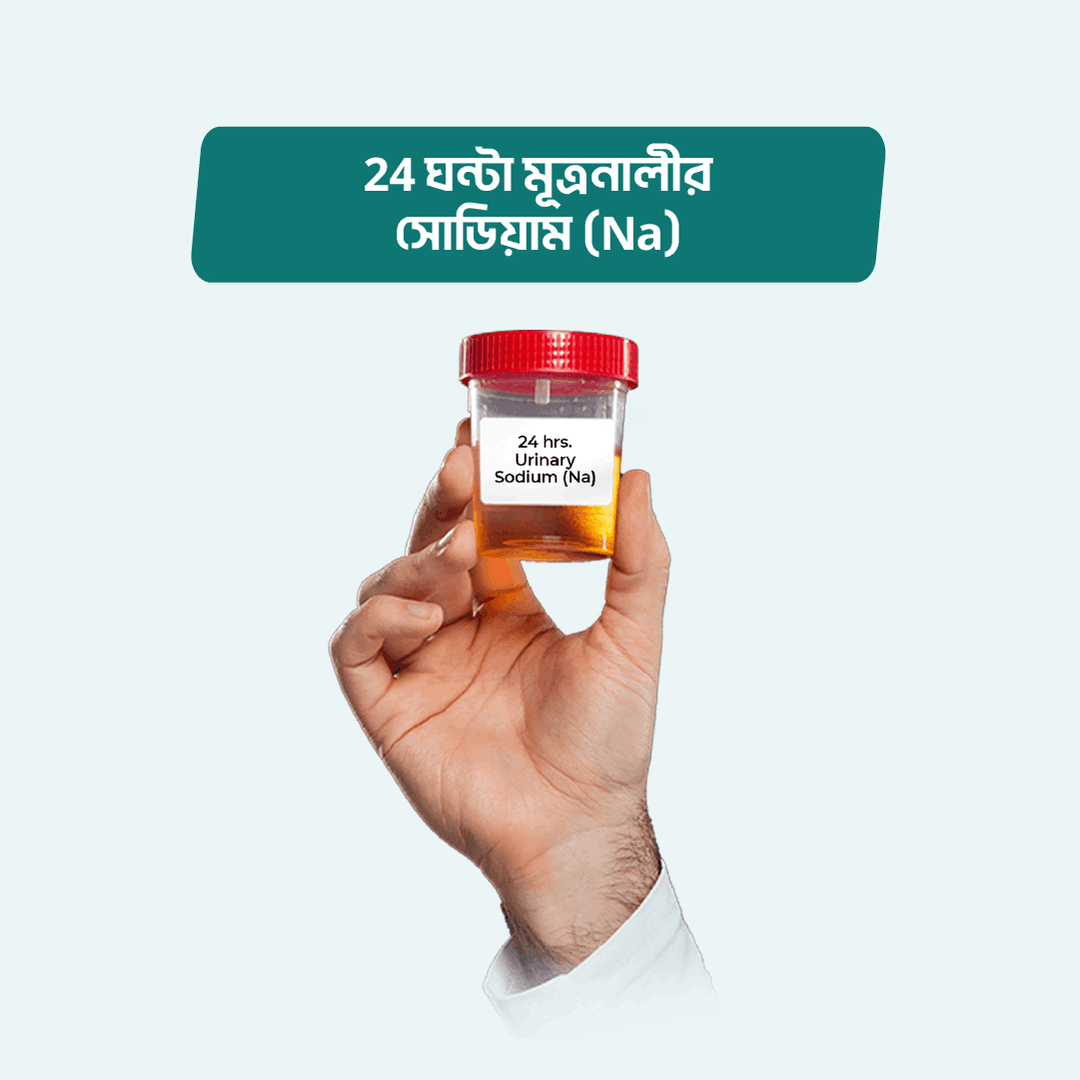 24 hrs. Urinary Sodium (Na)