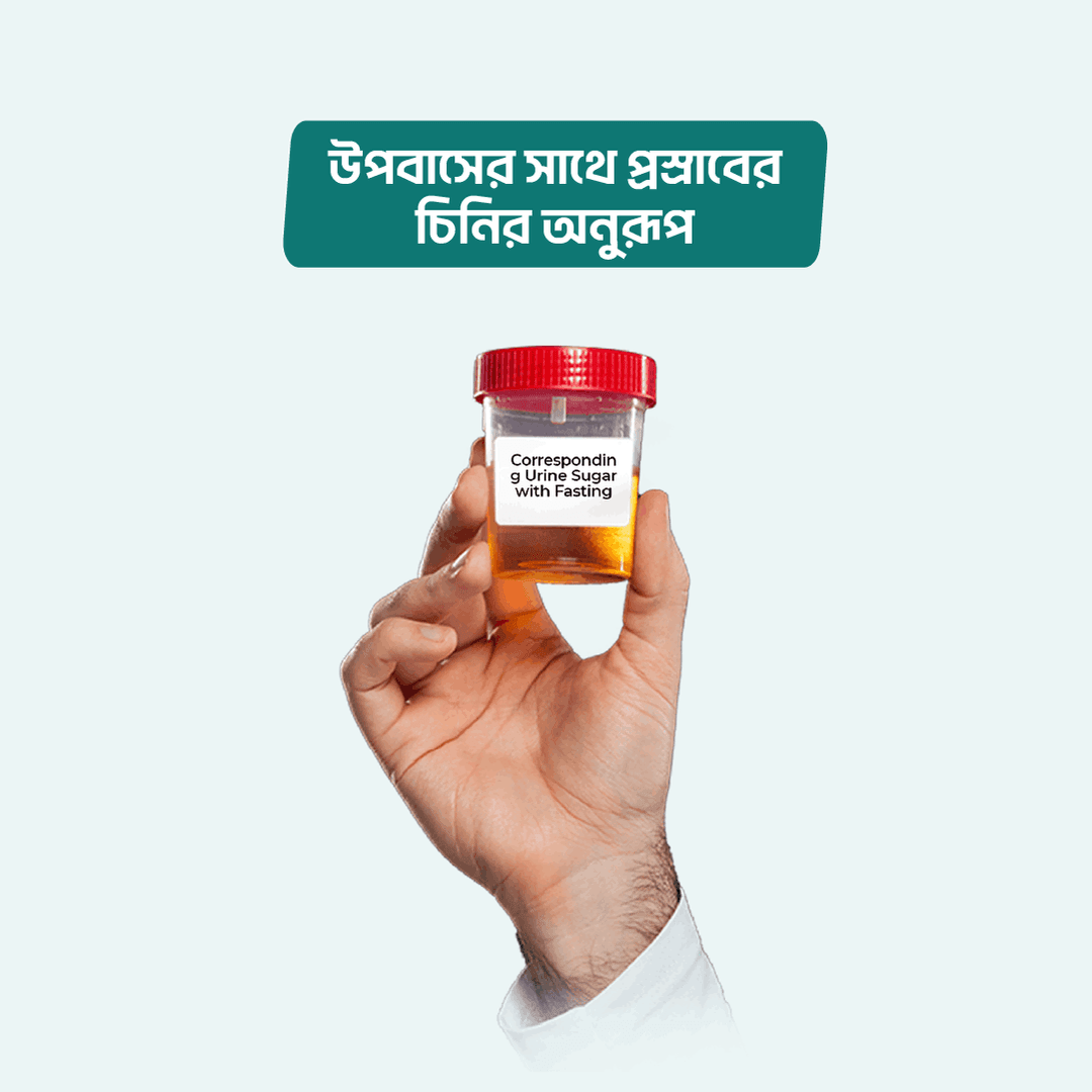 Glucose (Fasting) with Corresponding Urine Sugar