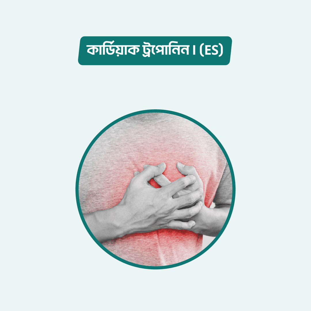 Cardiac Troponin-I (ES)/Troponin-I (ICT)