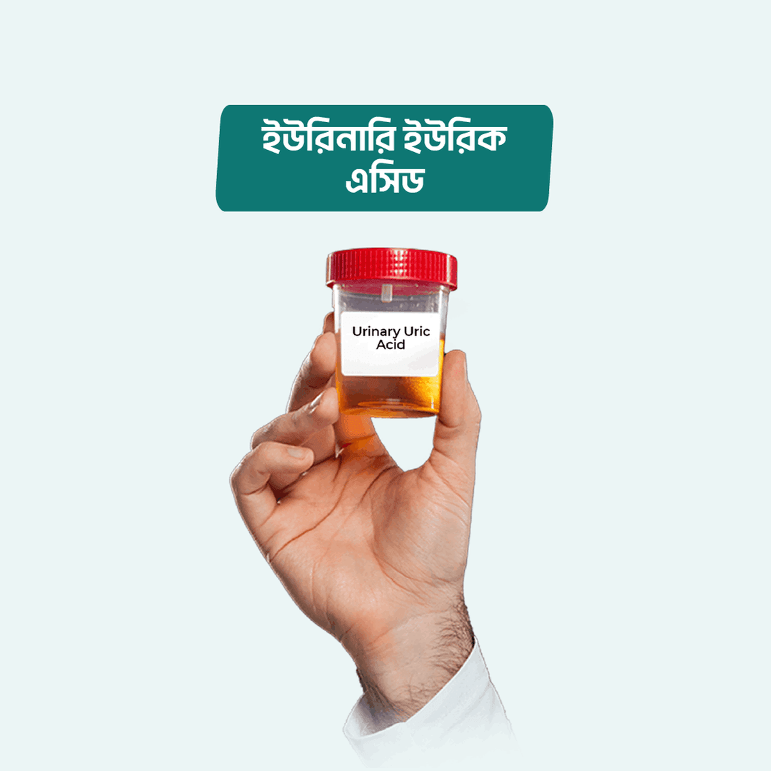 Urinary Uric Acid
