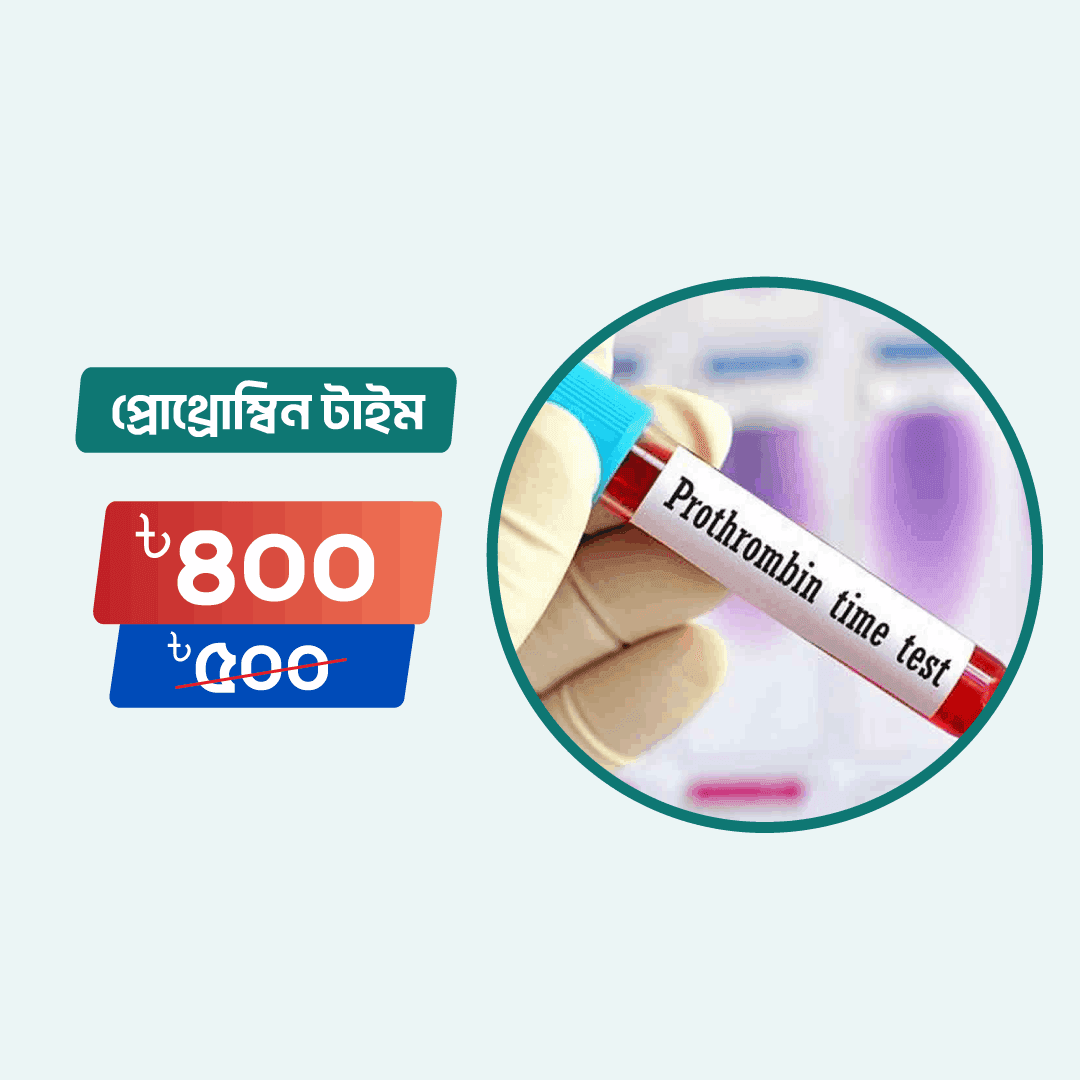 Prothrombin Time (PT)