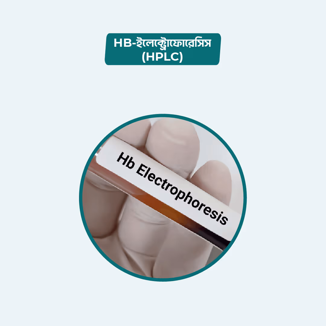 Hb Electrophoresis