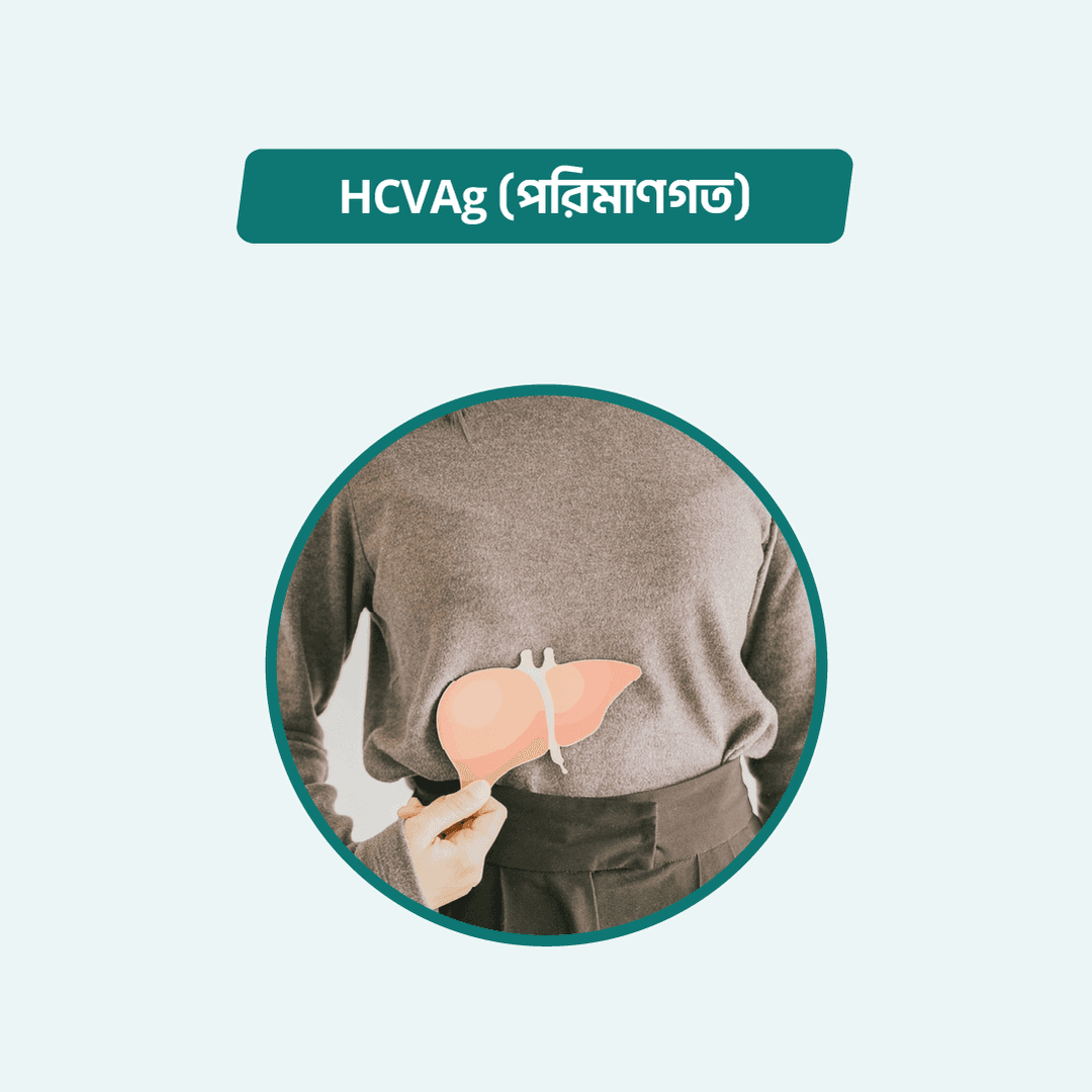 HCVAg(Quantitative)