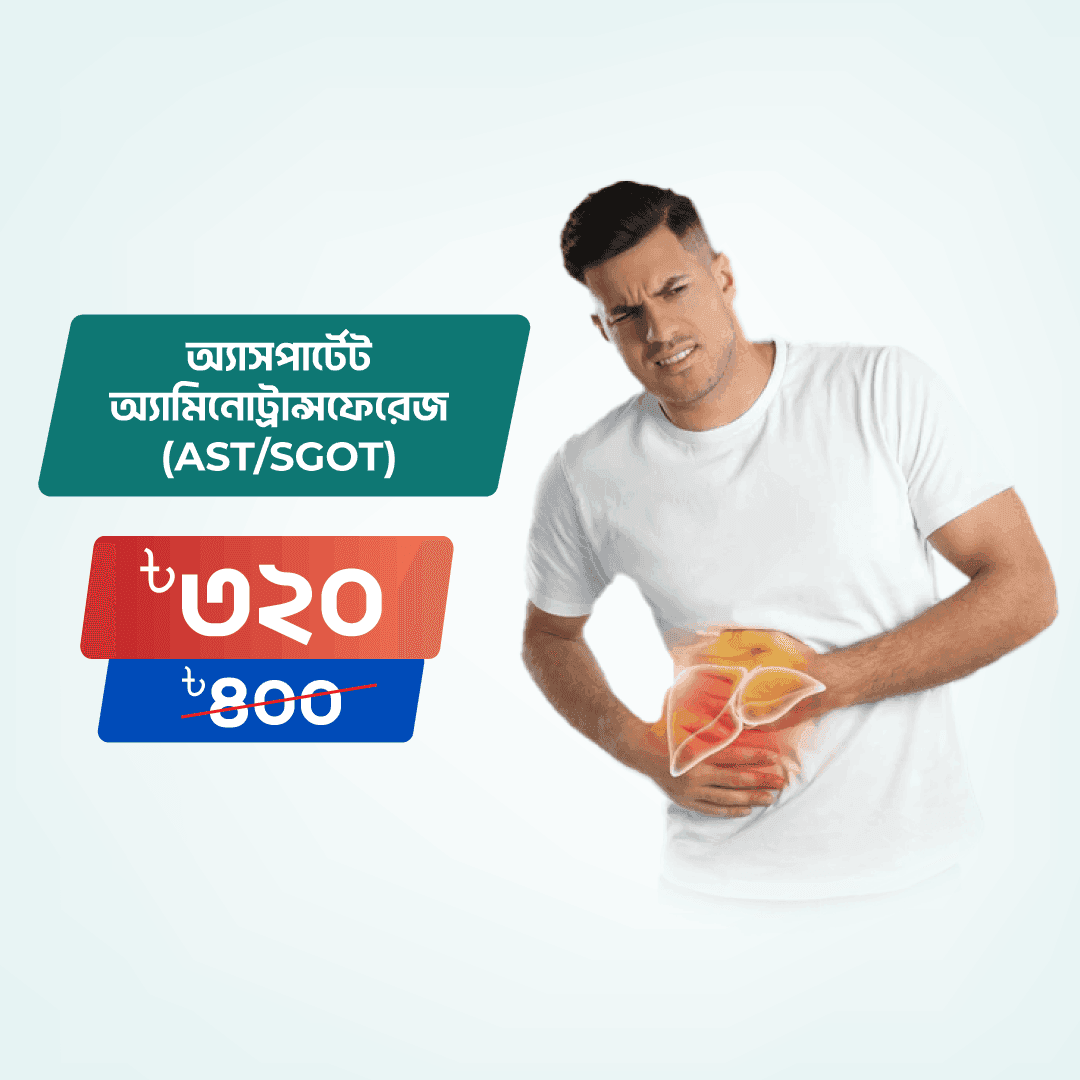 Aspartate Aminotransferase (AST/SGOT)