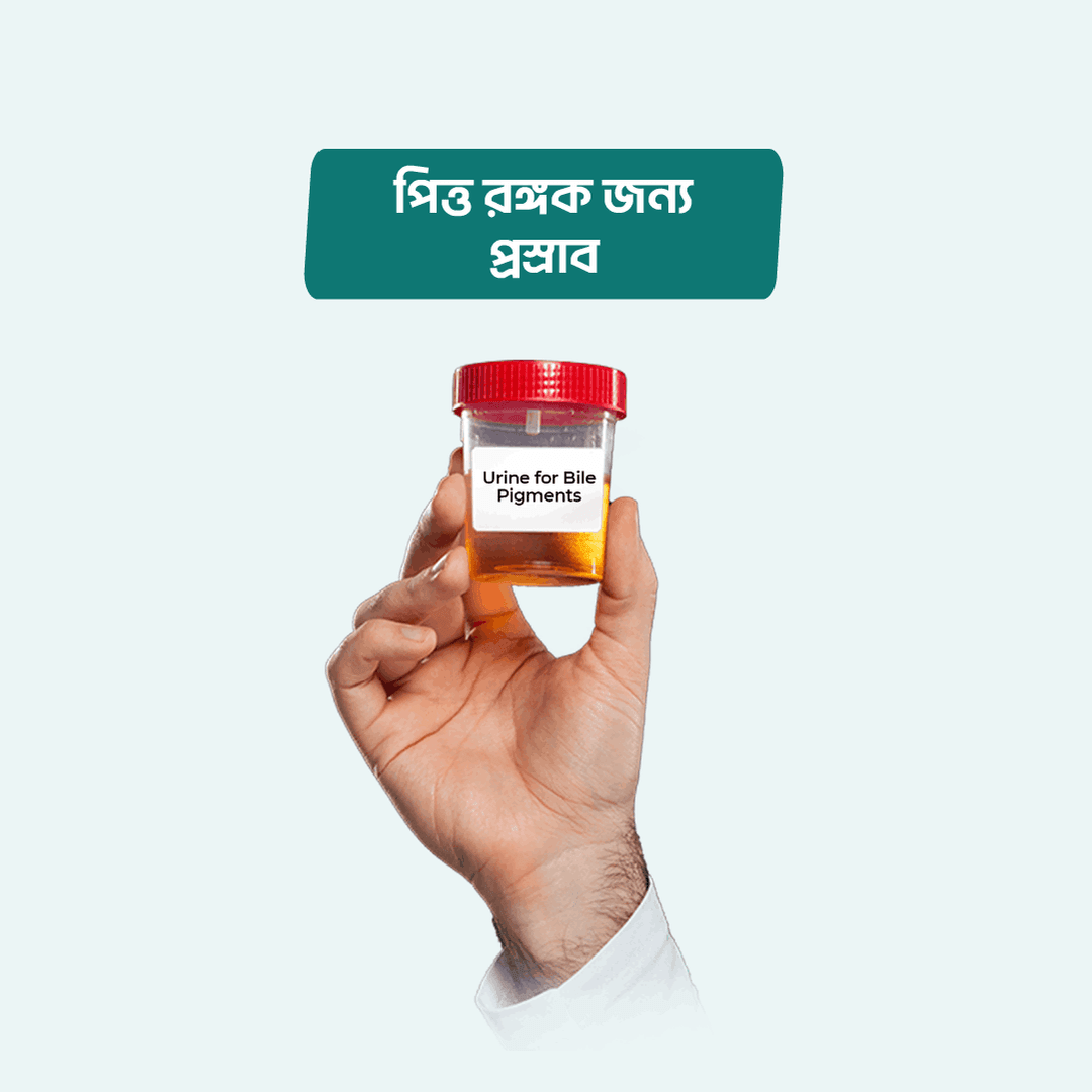 Urine for Bile Pigments