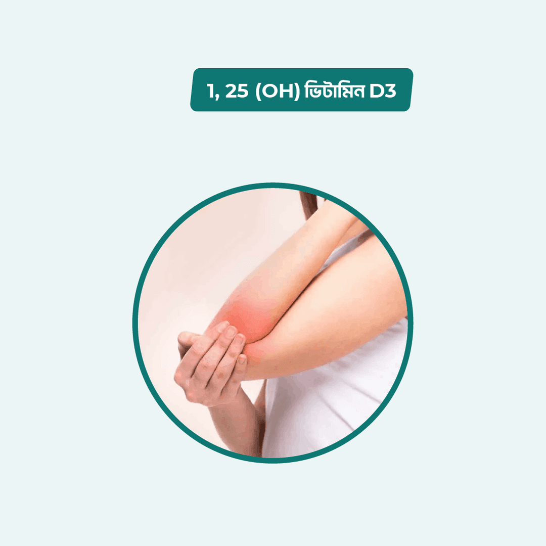 Vitamin D ( 25 - OH )