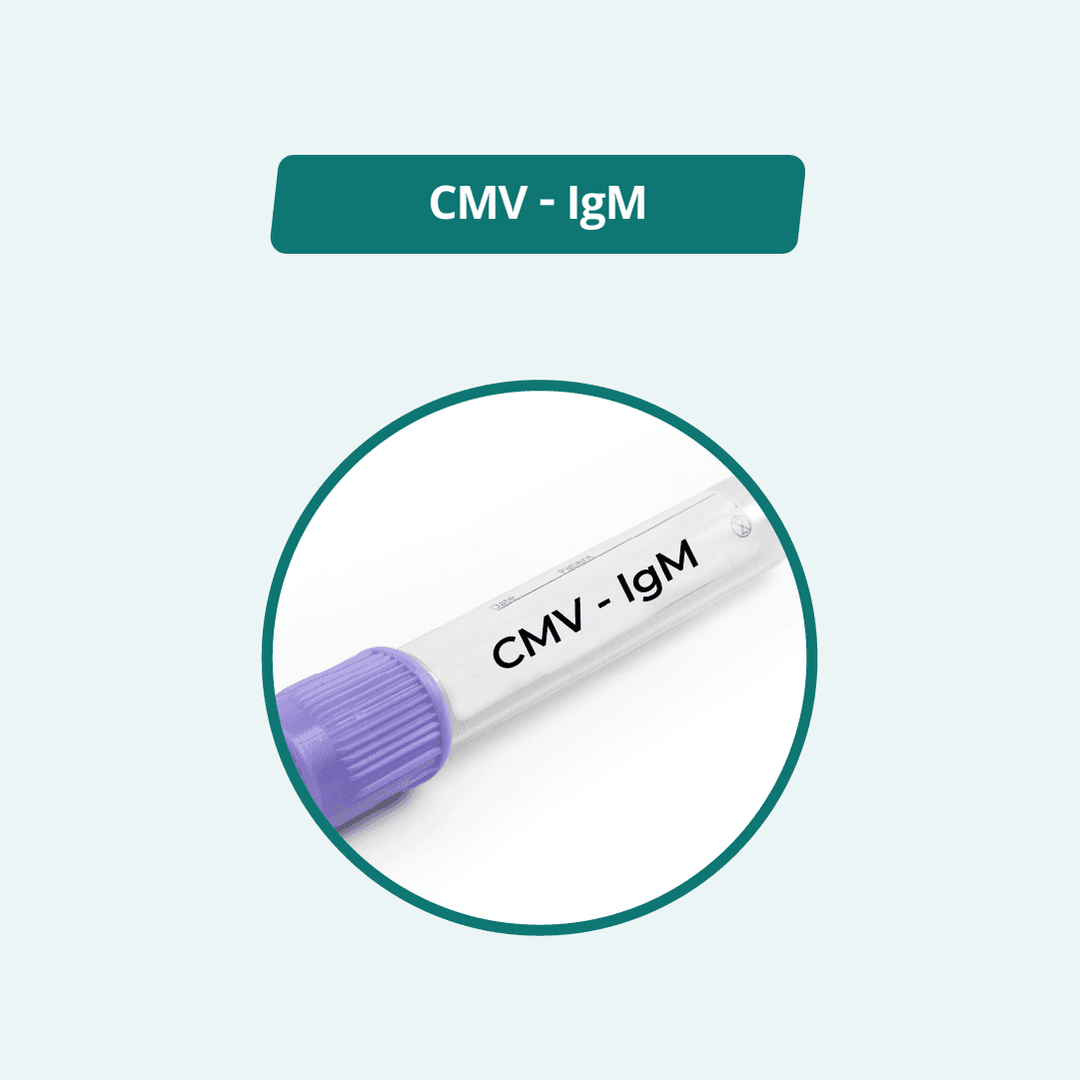 CMV - IgG