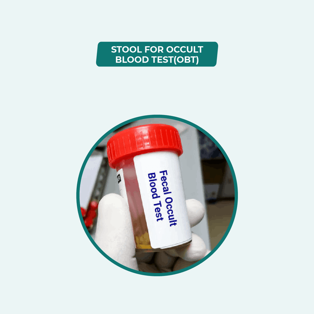 Stool for Occult Blood Test