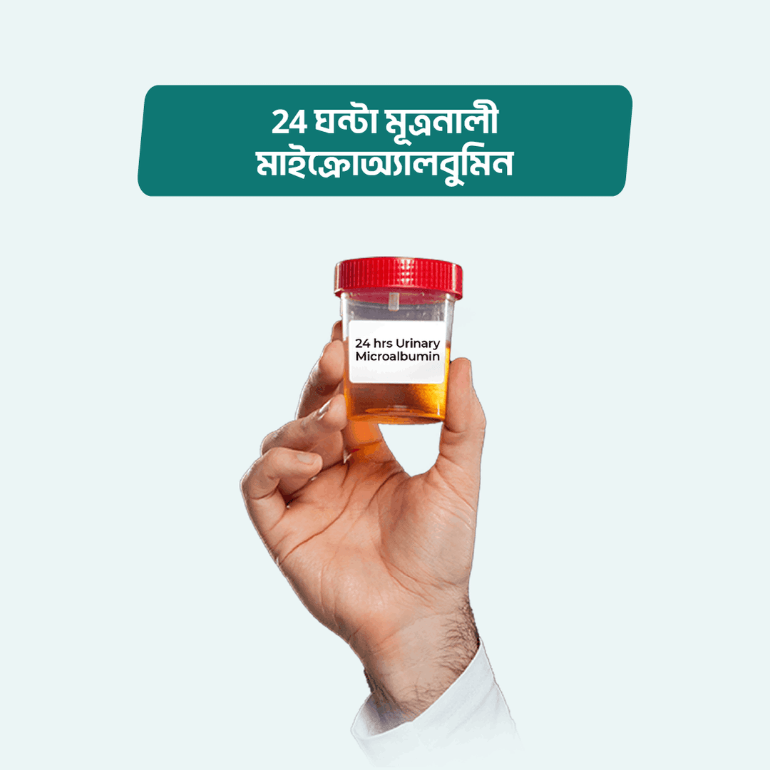 24 hrs Urinary Microalbumin