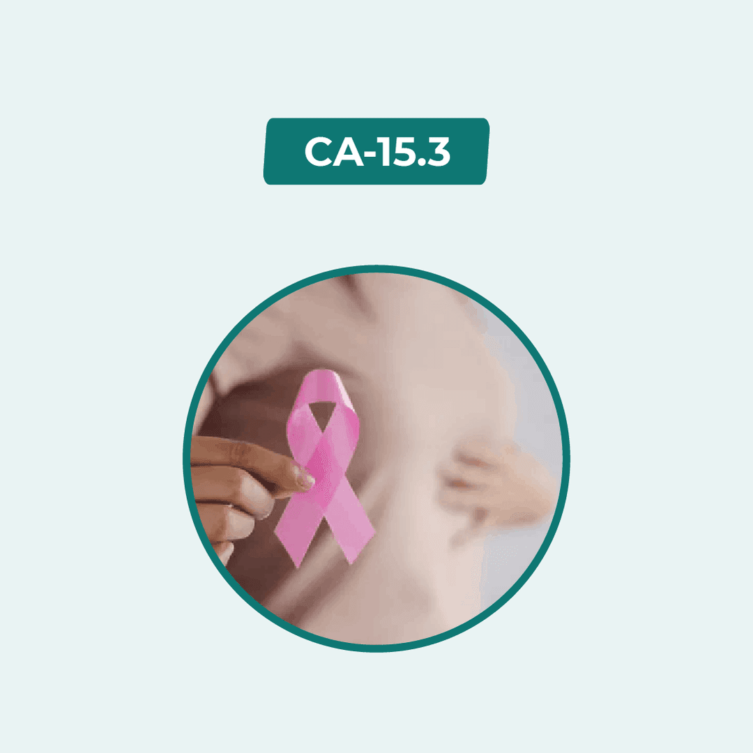 CA 15-3/Cancer Antigen (CA -15-3)