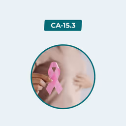 CA 15-3/Cancer Antigen (CA -15-3)