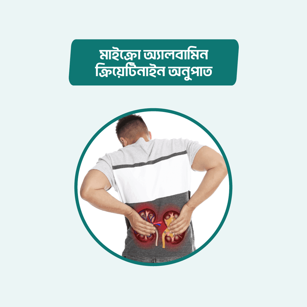 Micro Albumin Creatinine Ratio