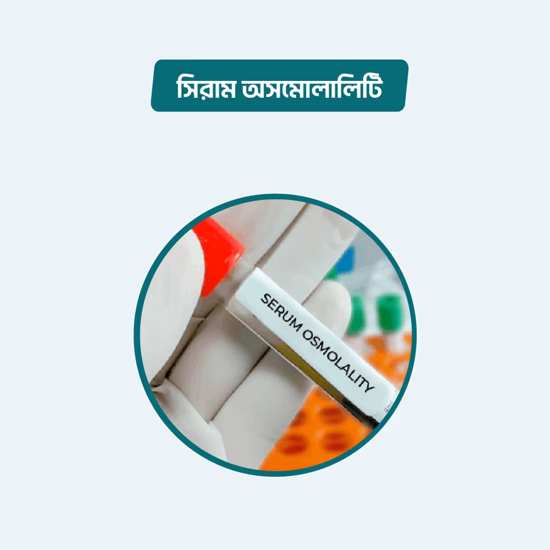 Serum Osmolality