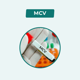 MCV