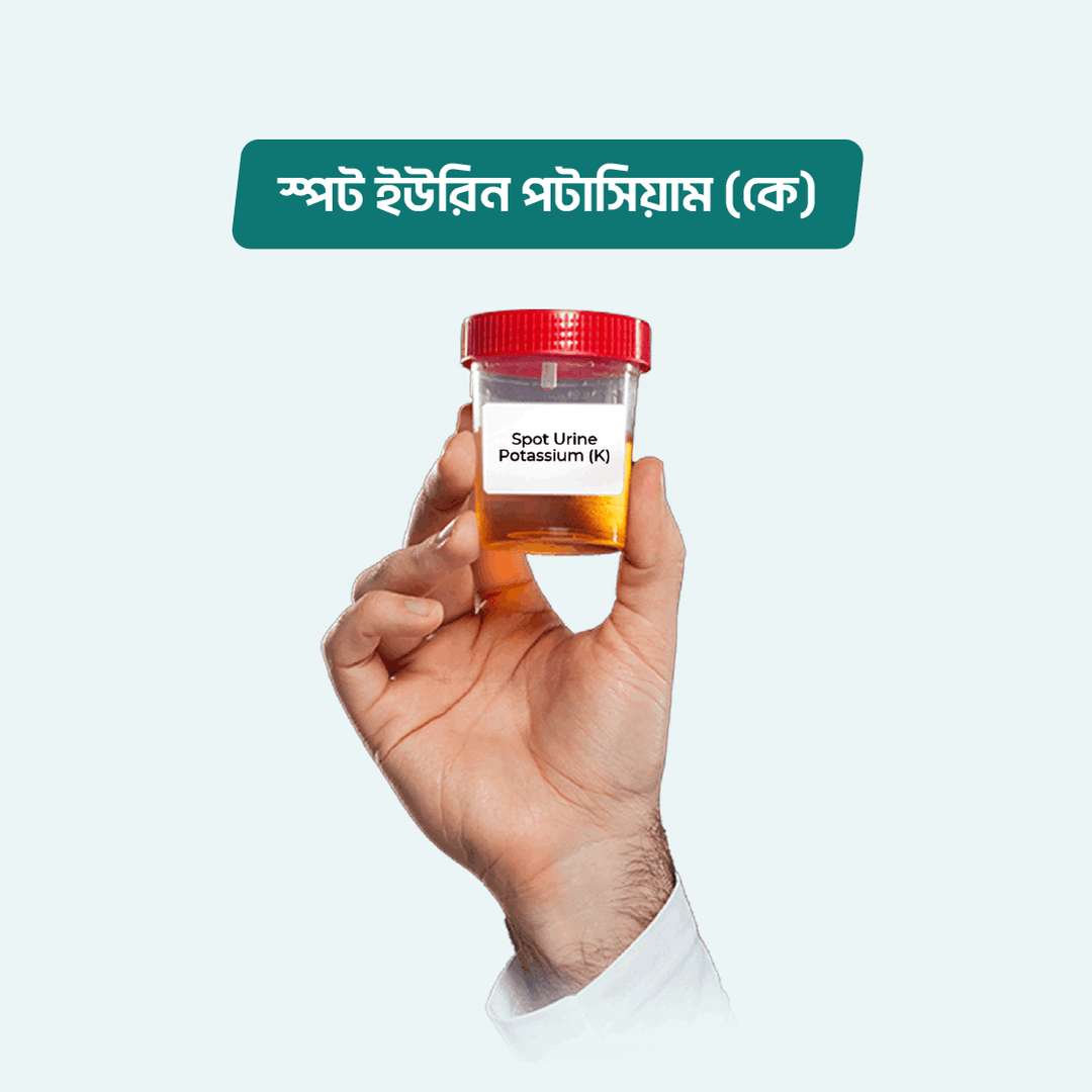 Spot Urine Potassium (K)
