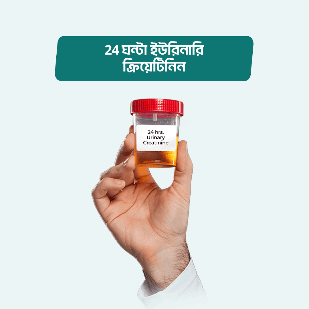 24 hrs. Urinary Creatinine