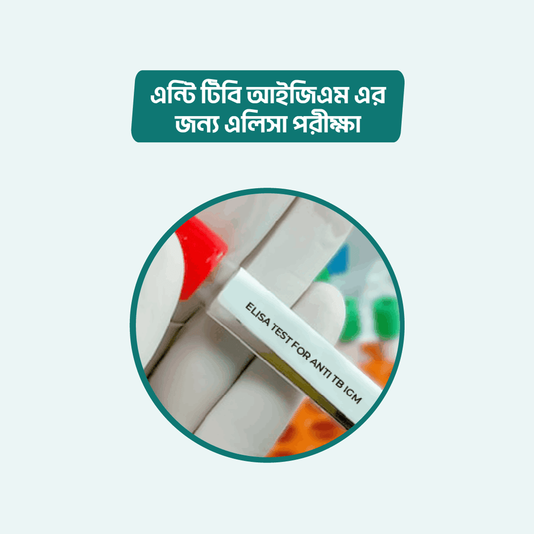 ELISA test for Anti TB IgM