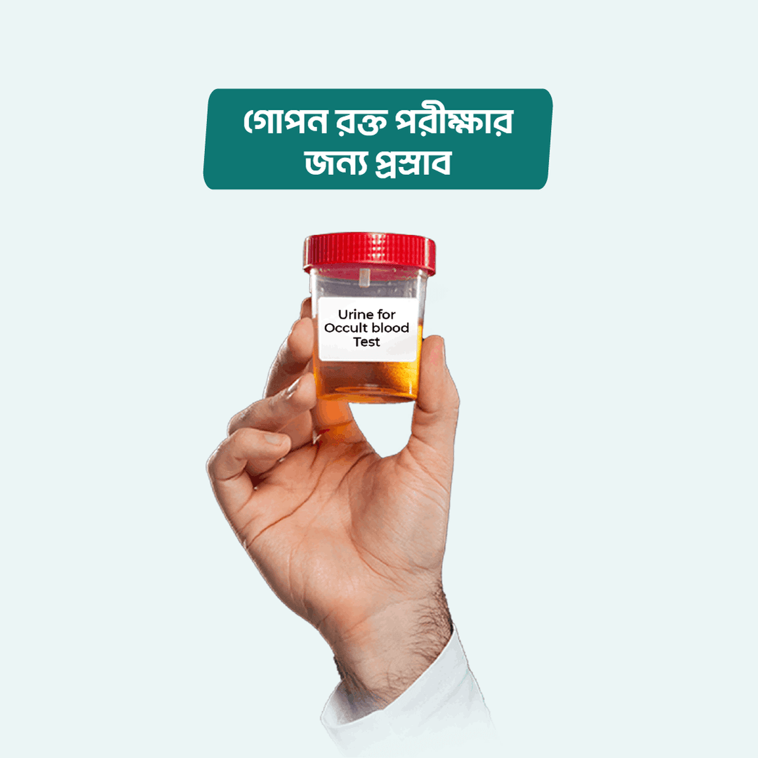 Urine for Occult blood Test
