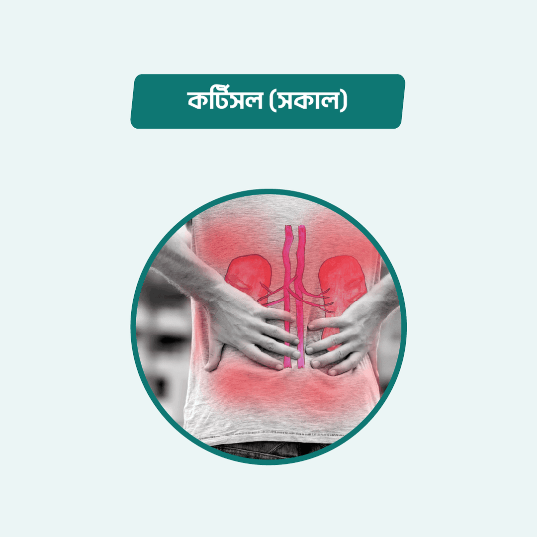 Cortisol (Morning)/BASAL CORTISOL (RANDOM)