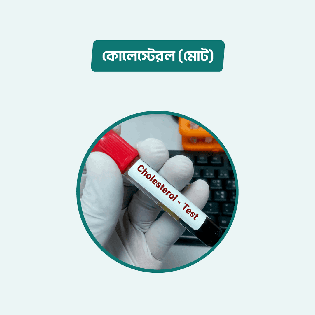 Cholesterol (Total)